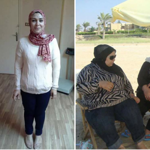 احد حالات دكتور اسامه فؤاد
